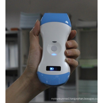 Portable 128 Elements Color Doppler Handheld Wireless Ultrasound Scanner Convex and Linear Probe